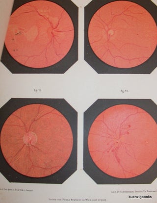 Ophthalmoscopical Atlas