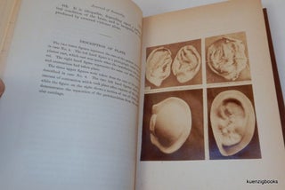 Item #25489 [Photographically Illustrated Books] "Haematoma Auris" IN The American Journal of...