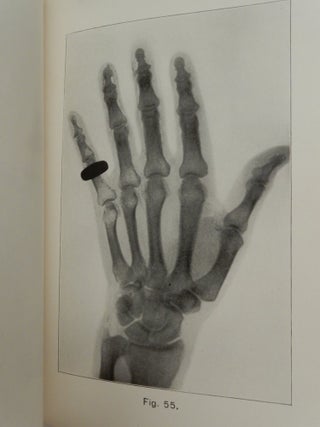 The X RAY or Photography of the Invisible and Its Value in Surgery