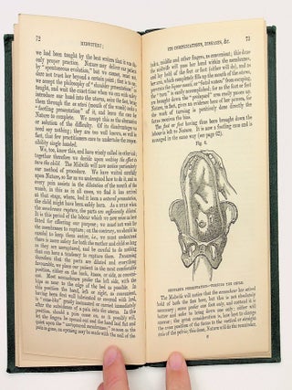 MIDWIFERY; Its Complications, Diseases, &c. Dedicated to the Members of the Female Class of the British Hygienic & Domestic Medical Society of London, and the Midwives and Mothers of the United Kingdom