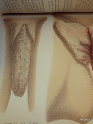Diseases of the Tubes, Ligaments, Pelvic Peritoneum and Pelvic Cellular Tissue; Extra-Uterine Pregnancy by L. Bandl WITH Diseases of the External Female Genitals; Lacerations of the Perineum by P. Zweifel